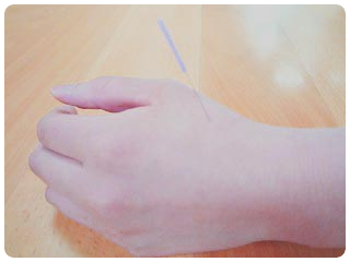 灸治療鍼治療 灸治療鍼治療
